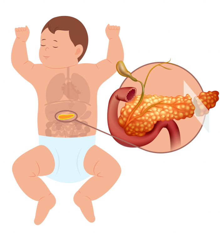 Milano: bimbo di tre mesi operato al pancreas, successo dell’intervento