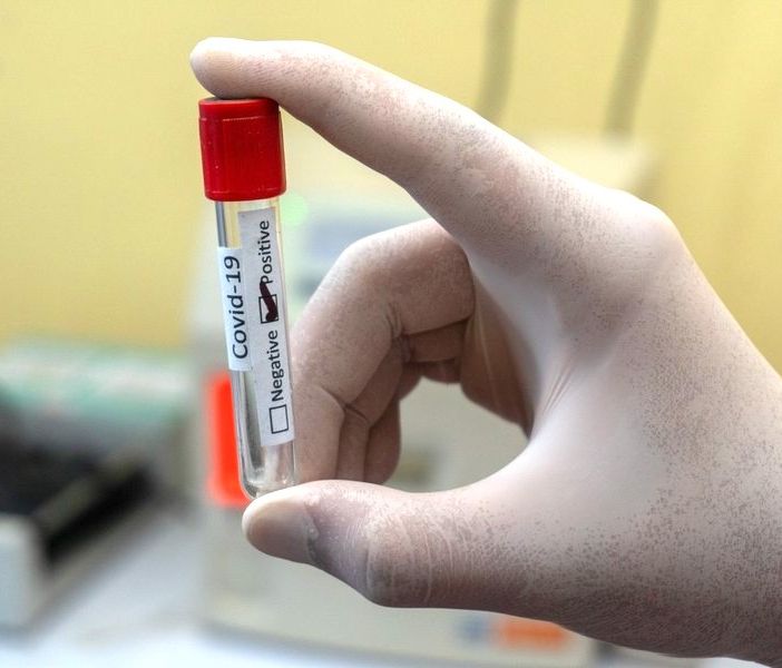 Covid, voli Cina: &quot;Dai primi risultati solo varianti Omicron già presenti in Italia&quot;