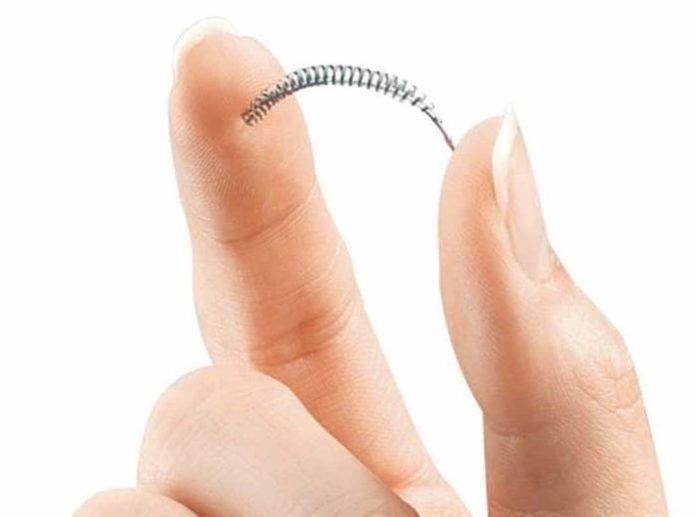 Pavia: Essure, dispositivo contraccettivo permanente sotto accusa