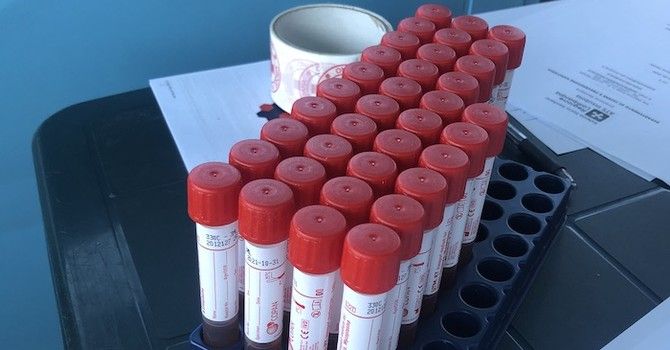 Coronavirus, i comuni con più di 40 contagi in provincia di Pavia al 21 giugno