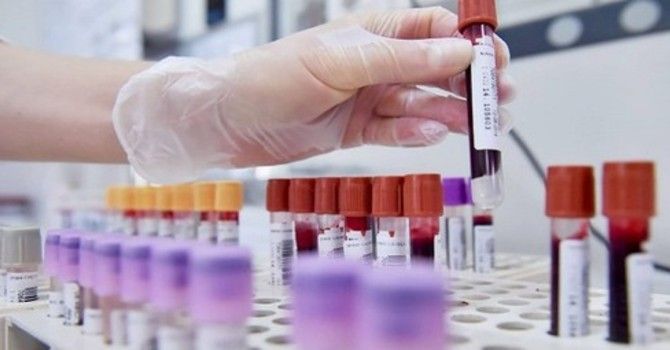 Coronavirus: comune per comune i dati dei casi confermati in provincia di Pavia al 6 aprile