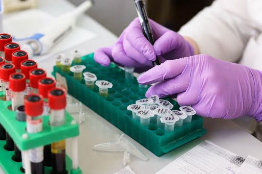 Robbio, test sierologici partiti circa un mese e mezzo fa. Ora arriva il via libera della Regione