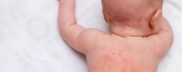 Milano, bimba ferita dallo spray della madre: violenza preoccupante Milano, bimba ferita dallo spray della madre: violenza preoccupante