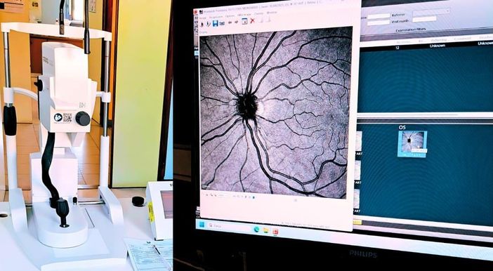 Vigevano, fluorangiografo di ultima generazione operativo presso l'oculistica del civile Vigevano, fluorangiografo di ultima generazione operativo presso l'oculistica del civile