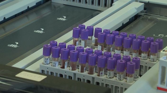 Covid, bloccata in Italia la terapia con l'idrossiclorochina