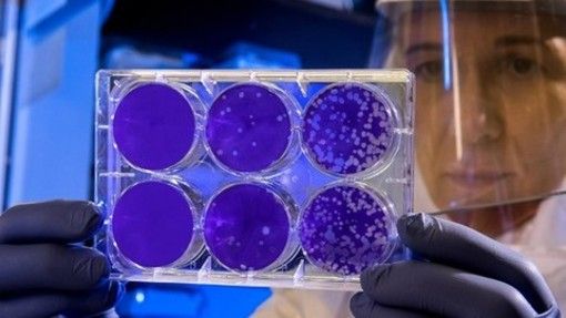 Forse una buona notizia dalla Francia nella lotta al Coronavirus