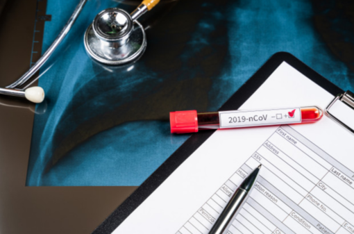 Coronavirus, in Piemonte tamponi anche ai medici di famiglia e agli operatori del 118 Coronavirus, in Piemonte tamponi anche ai medici di famiglia e agli operatori del 118