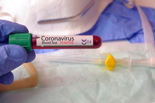 Coronavirus, in Svizzera 132 positivi in un giorno. Più di quelli registrati ieri in Italia (114)