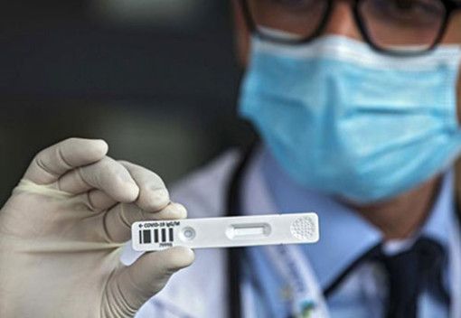 Test sierologici, attesa per domani la delibera della Regione per eseguirli privatamente Test sierologici, attesa per domani la delibera della Regione per eseguirli privatamente