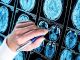 Nuova frontiera anti-Alzheimer: così si combattono le proteine tossiche