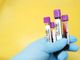 Coronavirus, continua la discesa: in provincia di Pavia 45 contagi. In Lombardia 796 casi e 18 vittime