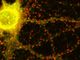 Scoperto un nuovo gene coinvolto nella malattia di Alzheimer: la pubblicazione dello studio coordinato dalle &quot;Molinette&quot; di Torino