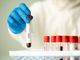 Coronavirus, in provincia di Pavia 1.383 nuovi contagi. In Lombardia 26.773 casi, in Italia 149.512