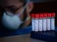 Coronavirus, in provincia di Pavia 150 nuovi contagi. In Lombardia 2.359 casi e 18 decessi