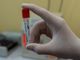 Coronavirus, in provincia di Pavia oggi 124 contagi. In Lombardia 2.974 casi e 81 vittime