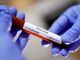Coronavirus, in provincia di Pavia 52 nuovi contagi. In Lombardia 1.005 casi e 15 vittime