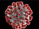 Progetto ALFABETO “ALL FAster, BEtter, TOgether - SARS-CoV2” , Intelligenza artificiale a supporto della clinica