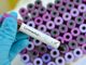 Coronavirus, l'annuncio a sorpresa dell'Oms: «Raro che gli asintomatici contagino»