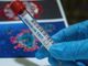 Coronavirus, i comuni con più di 40 contagi in provincia di Pavia al 17 giugno