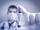 La fase &quot;sconosciuta&quot; del Coronavirus: «In Lombardia almeno 1.200 contagiati già prima del paziente 1»