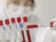 Coronavirus, comune per comune i dati dei positivi in provincia di Pavia al 7 aprile