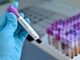 Coronavirus, i comuni con più di 35 contagi in provincia di Pavia al 19 maggio