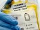 Lombardia, istituire la banca regionale del plasma per combattere il Covid-19