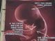 Il manifesto anti aborto rimosso a Roma rispunta nel Biellese