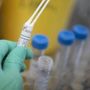 Legionella in case popolari a Milano, un morto e diversi ricoverati
