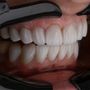 Estetica del sorriso, i numeri in crescita di una tendenza trasversale