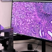 Progetto Pnrr anatomia patologica digitale: ASST Pavia installa i nuovi scanner per vetrini istologici negli ospedali di Vigevano e Voghera
