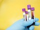 Coronavirus, in provincia di Pavia oggi 85 contagi. In Lombardia 2.569 casi e 109 vittime Coronavirus, in provincia di Pavia oggi 85 contagi. In Lombardia 2.569 casi e 109 vittime