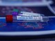 Coronavirus, i comuni con più di 35 contagi in provincia di Pavia al 28 maggio Coronavirus, i comuni con più di 35 contagi in provincia di Pavia al 28 maggio