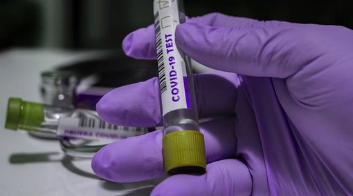 Covid-19, in Italia oggi 18.627 e 361 vittime. La Lombardia torna la regione più colpita