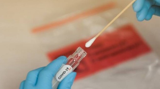 Covid-19, in Italia oggi 14.078 casi e 521 vittime. In Lombardia 2.234 contagi Covid-19, in Italia oggi 14.078 casi e 521 vittime. In Lombardia 2.234 contagi