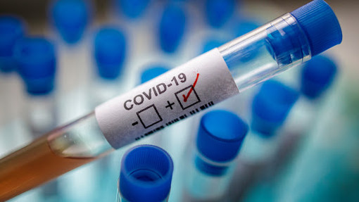 Covid-19, aumentano i tamponi ma calano i contagi: in Italia oggi 8.585 nuovi positivi Covid-19, aumentano i tamponi ma calano i contagi: in Italia oggi 8.585 nuovi positivi
