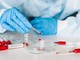 Covid-19, in Italia oggi 13.908 nuovi positivi e 316 decessi. Oltre trecentomila i tamponi analizzati Covid-19, in Italia oggi 13.908 nuovi positivi e 316 decessi. Oltre trecentomila i tamponi analizzati