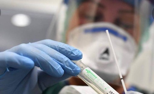 Covid-19, in Italia oggi 17.246 contagi e 522 vittime. Lombardia, Veneto e Sicilia le regioni più colpite Covid-19, in Italia oggi 17.246 contagi e 522 vittime. Lombardia, Veneto e Sicilia le regioni più colpite