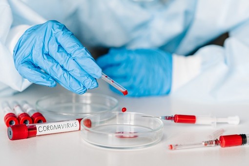 Covid-19, in Italia oggi 13.908 nuovi positivi e 316 decessi. Oltre trecentomila i tamponi analizzati Covid-19, in Italia oggi 13.908 nuovi positivi e 316 decessi. Oltre trecentomila i tamponi analizzati