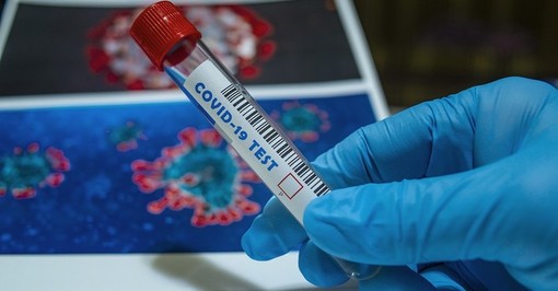 Coronavirus, i comuni con più di 40 contagi in provincia di Pavia al 17 giugno