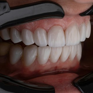 Estetica del sorriso, i numeri in crescita di una tendenza trasversale