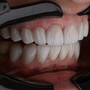 Estetica del sorriso, i numeri in crescita di una tendenza trasversale