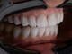 Estetica del sorriso, i numeri in crescita di una tendenza trasversale