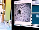 Vigevano, fluorangiografo di ultima generazione operativo presso l'oculistica del civile Vigevano, fluorangiografo di ultima generazione operativo presso l'oculistica del civile