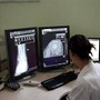 Un italiano su 4 è over 65, Sirm: &quot;Prevenzione personalizzata con radiologia geriatrica&quot;