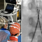 Incidente con un'acquasantiera in chiesa, bimba di 6 anni operata d'urgenza all'aorta a Bari Incidente con un'acquasantiera in chiesa, bimba di 6 anni operata d'urgenza all'aorta a Bari