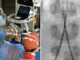 Incidente con un'acquasantiera in chiesa, bimba di 6 anni operata d'urgenza all'aorta a Bari Incidente con un'acquasantiera in chiesa, bimba di 6 anni operata d'urgenza all'aorta a Bari