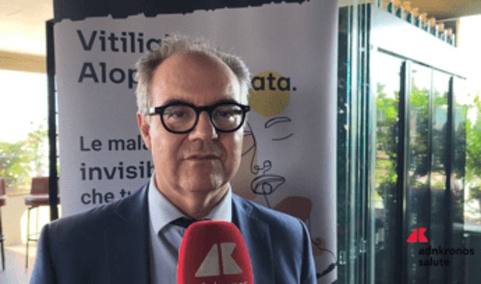 Costanzo (Sidemast): "Upadacitinib blocca cellule infiammatorie in vitiligine e alopecia areata" Costanzo (Sidemast): "Upadacitinib blocca cellule infiammatorie in vitiligine e alopecia areata"