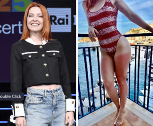 Dalla chioma alle gambe, Noemi ironizza sulla scottatura: &quot;Mai senza crema&quot;