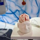 Dai gliomi al Parkinson, così l’intelligenza artificiale aiuta la Neurochirurgia Dai gliomi al Parkinson, così l’intelligenza artificiale aiuta la Neurochirurgia